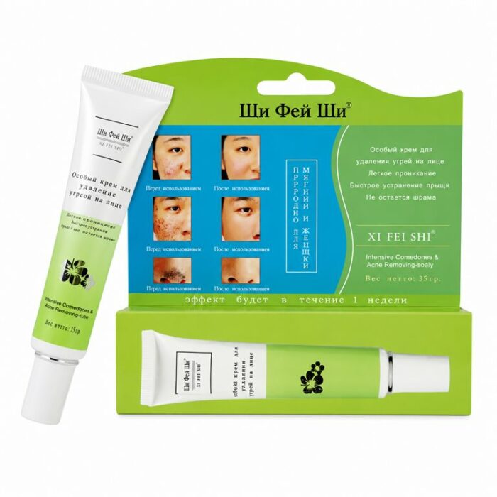 XI FEI SHI ACNE REMOVING PASTE 3.5G XI FEI SHI ACNE REMOVING PASTE 3.5G